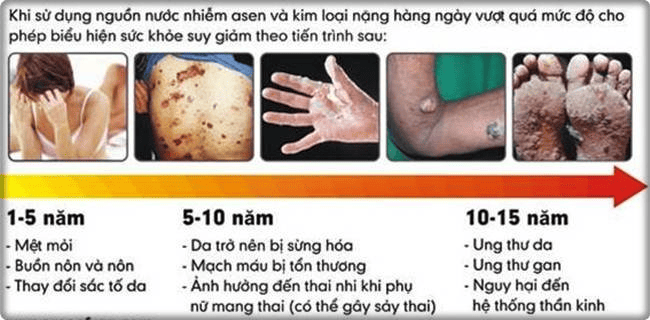 kim-loai-nang-4